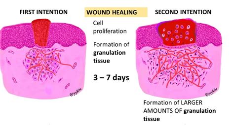 Fibrin: De Ultieme Biocompatibele Held in Weefselherstel en Wondgenezing!